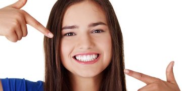 professional teeth whitening