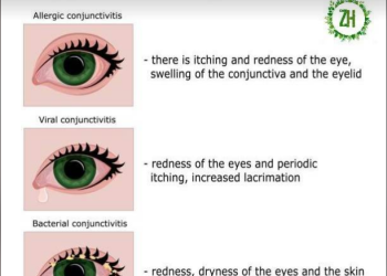 Pink Eye in Kids: Causes, Symptoms, and Effective Management