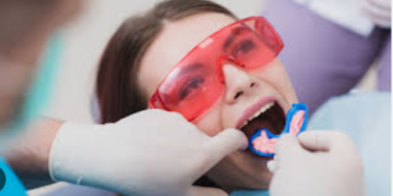 Fluoride Treatments and Their Benefits for Adults