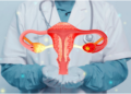 Endometriosis Unveiled: Shedding Light on a Common Women’s Health Condition