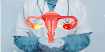 Endometriosis Unveiled: Shedding Light on a Common Women’s Health Condition