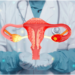 Endometriosis Unveiled: Shedding Light on a Common Women’s Health Condition