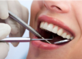 Top Reasons to See a General Dentist Before Problems Start