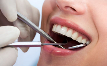 Top Reasons to See a General Dentist Before Problems Start