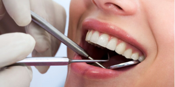 Top Reasons to See a General Dentist Before Problems Start