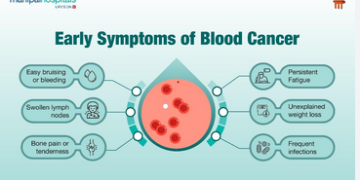Early signs of blood cancer blood cancer silently thrives in the body