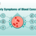 Early signs of blood cancer blood cancer silently thrives in the body