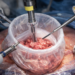 The Role of Morcellation Bags in Minimally Invasive Surgery