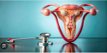 Endometriosis Unveiled: Shedding Light on a Common Women’s Health Condition