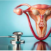 Endometriosis Unveiled: Shedding Light on a Common Women’s Health Condition