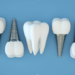 Top Reasons to Choose Dental Implants