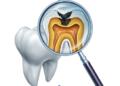How Long Does a Root Canal Take? A Complete Guide